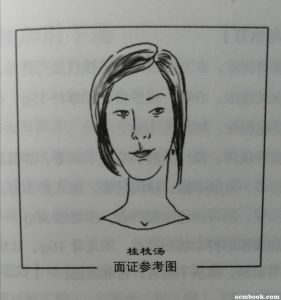 桂枝汤面证